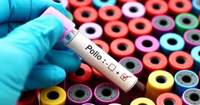Polio virus found in sewage sample of 18 districts