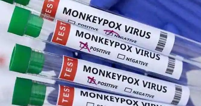 US may expand monkeypox vaccine eligibility to men with HIV