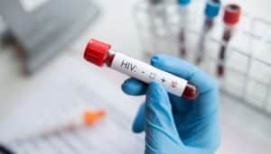HIV screening to be made mandatory before any surgery