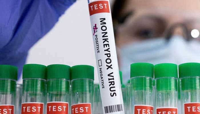 WHO to assist Pakistan contain monkeypox