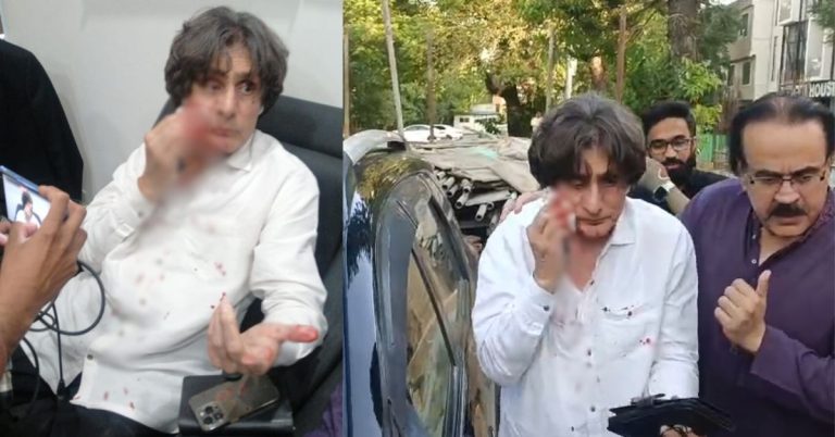 Raoof Hasan attacked