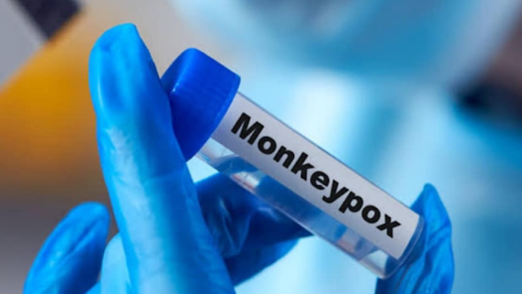 Investigation launched after Mpox patient slips through Islamabad