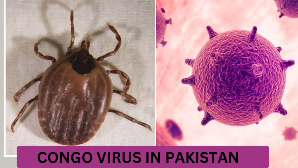 Balochistan reports two new cases of Congo virus