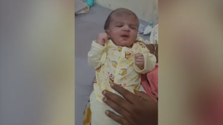 Miraculous surgery saves 10-day-old conjoined head girl in Faisalabad