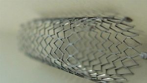 Pakistan begins exporting cardiac stents