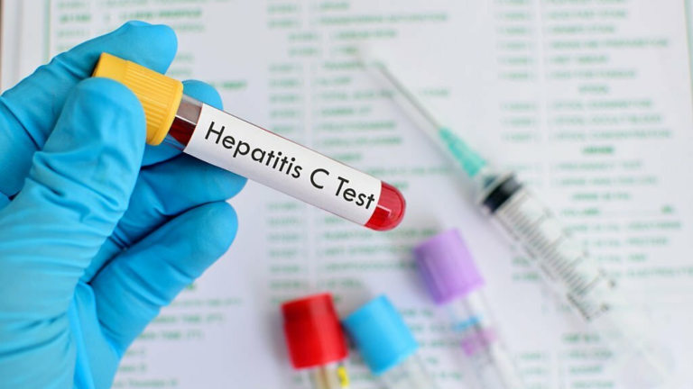 Rawalpindi residents to get free Hepatitis treatment under new MoU