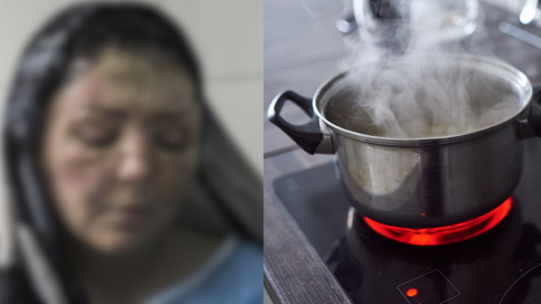 Cruel husband burns wife with boiling water