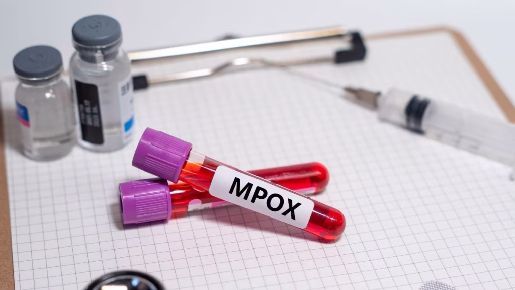 Pakistan Mpox case