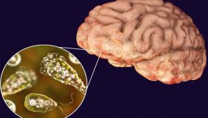 ''Brain Rot'' not just meme but actual disorder, new study reveals