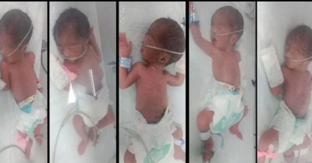 Quintuplets born to Karachi couple in exceptional case