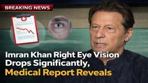 Imran Khan Right Eye Vision Drops