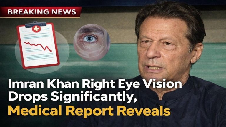 Imran Khan Right Eye Vision Drops