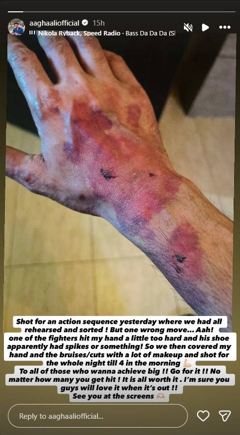 Aagha Ali injury