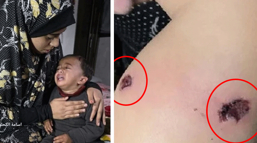 انسانیت لرز اٹھی! اسرائیلی فوج نے معصوم بچے کو سگریٹ سے داغ دیا، ویڈیو وائرل